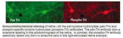 Immunohistochemistry: Tyrosine Hydroxylase [p Ser40] Antibody [NB300-173]